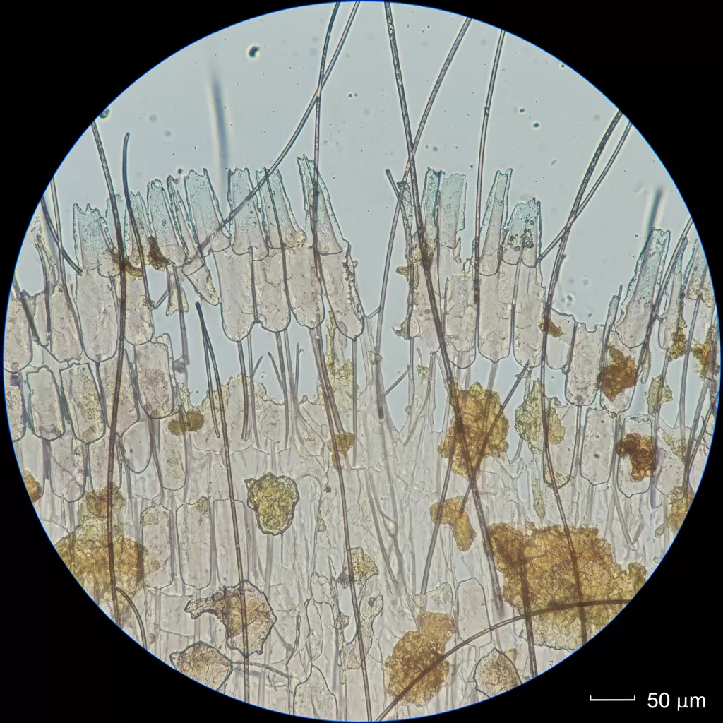 Lớp biểu bì tóc bị bong tróc và hư tổn nghiêm trọng sau khi tiếp xúc với hóa chất mạnh