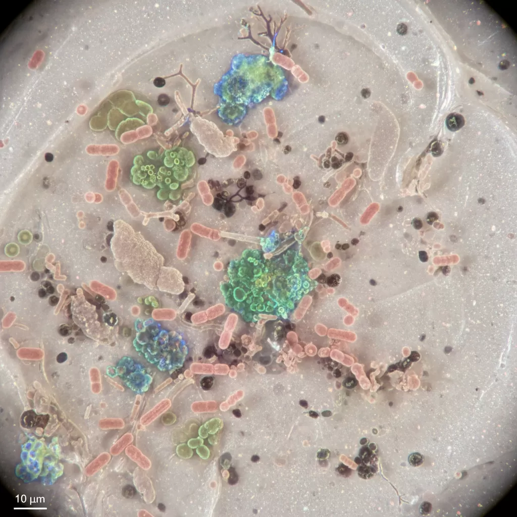 Nguy cơ nhiễm khuẩn là một vấn đề cần lưu ý đối với các sản phẩm thiên nhiên thiếu chất bảo quản