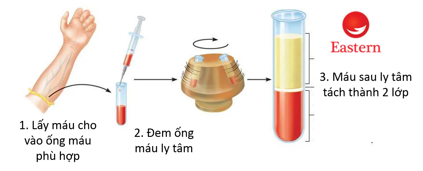 Thời điểm lấy máu vào buổi sáng sớm giúp các chỉ số hormone đạt độ chính xác cao