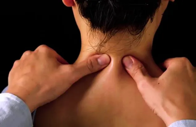 Bấm huyệt Phong trì là liệu pháp tự nhiên giúp cải thiện sức khỏe vùng cổ và tóc
