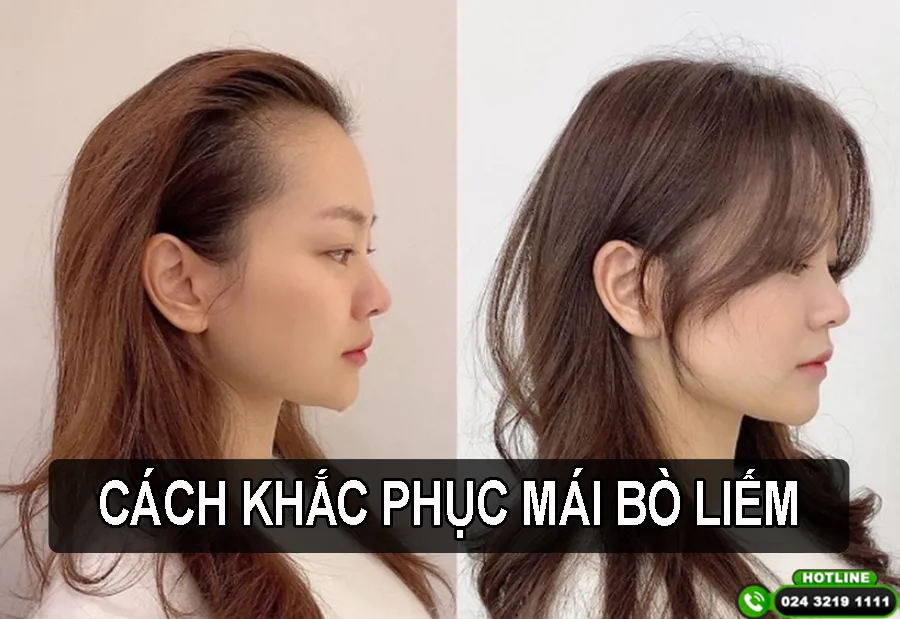 Tóc bò liếm thường gây khó khăn trong việc tạo kiểu và giữ nếp tóc tự nhiên