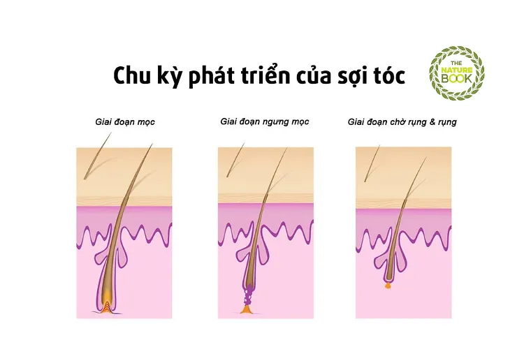 Cơ chế Telogen Effluvium khiến tóc rụng hàng loạt sau cú sốc sức khỏe