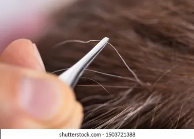 Nhổ tóc bạc không làm tóc mọc nhiều hơn nhưng có thể gây hỏng nang tóc vĩnh viễn