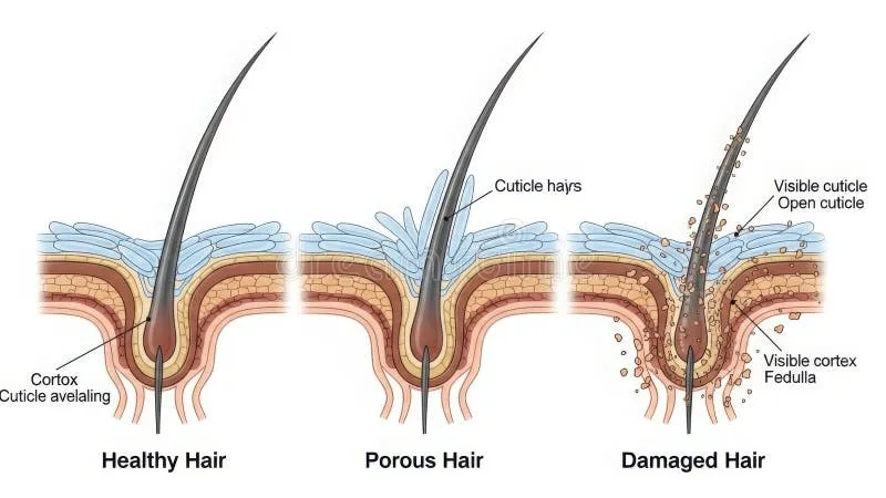 Sự khác biệt giữa cấu trúc tóc khỏe mạnh và tóc bị đứt gãy liên kết