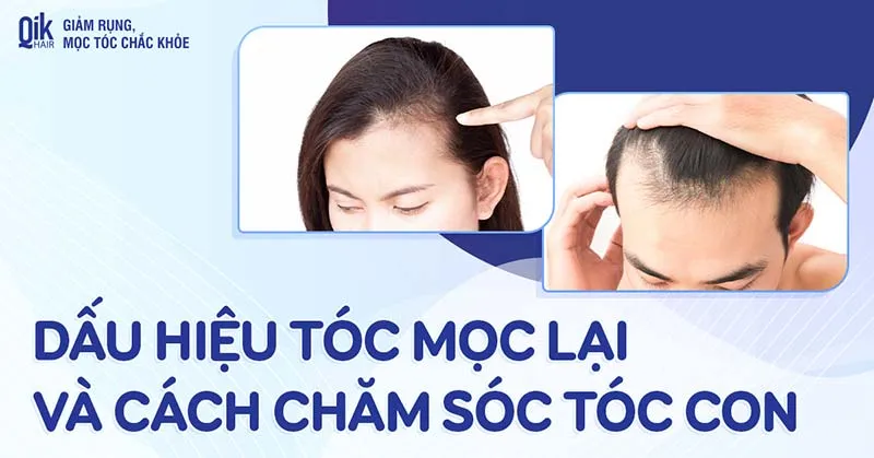 dau-hieu-moc-toc-lai Sự kiên trì trong dinh dưỡng sẽ giúp mái tóc phục hồi sau giai đoạn rụng