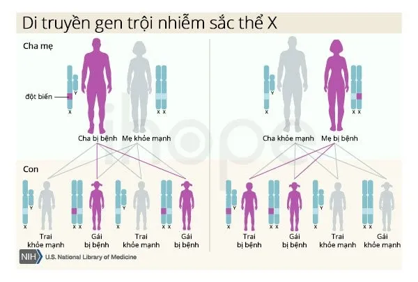 Cơ chế di truyền gen hói đầu thông qua nhiễm sắc thể X từ phía mẹ