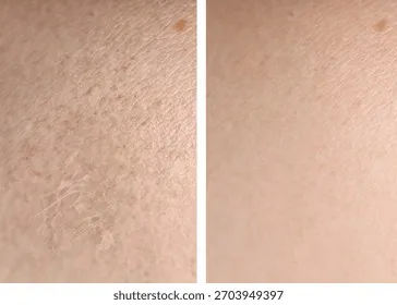 dry-skin-before-after-moisturizing-260nw-2703949397 Vitamin E giúp phục hồi cấu trúc da khô ráp trở nên mịn màng