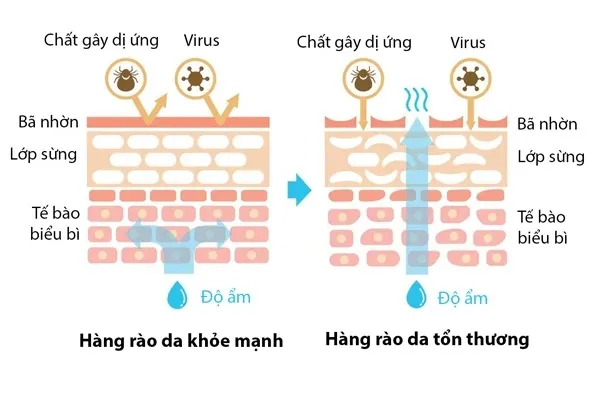 Lạm dụng axit mạnh có thể phá hủy hàng rào bảo vệ tự nhiên của da đầu