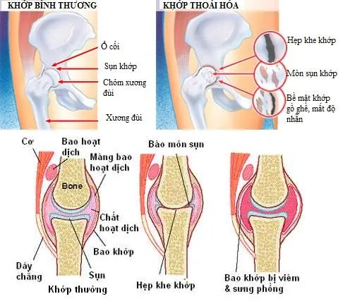 image01 Collagen trong nước hầm xương hỗ trợ tái tạo sụn khớp và giảm viêm