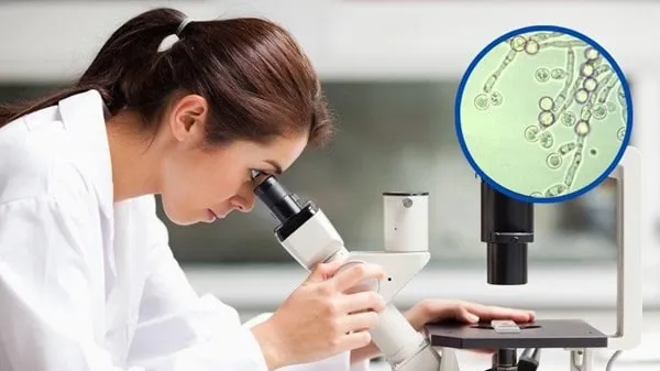 Quy trình soi tươi tìm nấm giúp xác định chính xác nguyên nhân gây bệnh để có phác đồ điều trị tối ưu