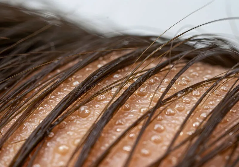 macro-photography-wet-hair-strands-water-droplets-close-up-view-human-texture-scalp-detailed-shot-showcasing-379749091 Nguồn nước sinh hoạt ảnh hưởng trực tiếp đến sức khỏe và vẻ đẹp của mái tóc