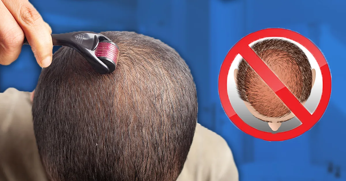 Ủ tê kỹ lưỡng là chìa khóa để giảm thiểu tối đa cảm giác đau rát khi lăn kim