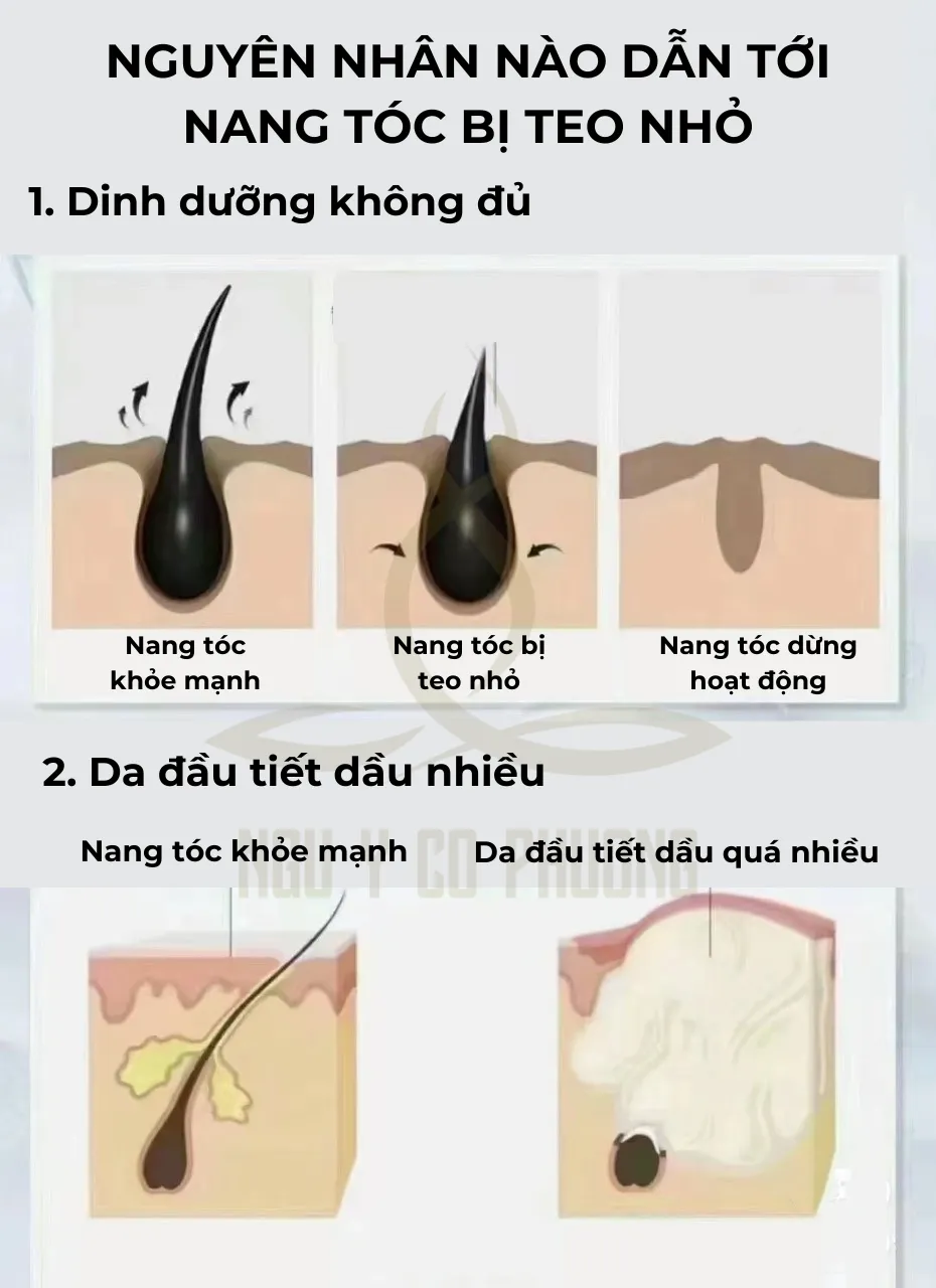 Mô phỏng khả năng len lỏi của bọt mịn vào sâu trong nang tóc để loại bỏ bã nhờn