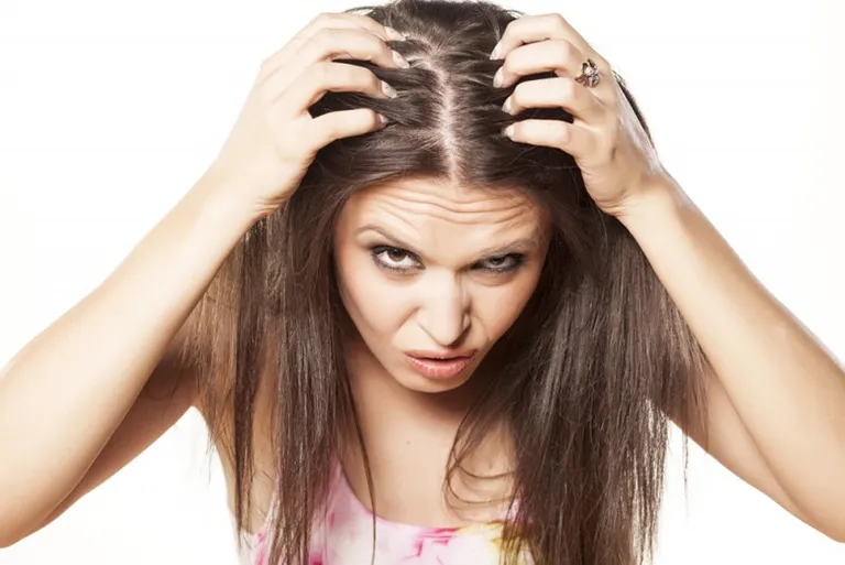 Tình trạng tóc rụng kèm ngứa gây ảnh hưởng lớn đến tâm lý và thẩm mỹ của người bệnh