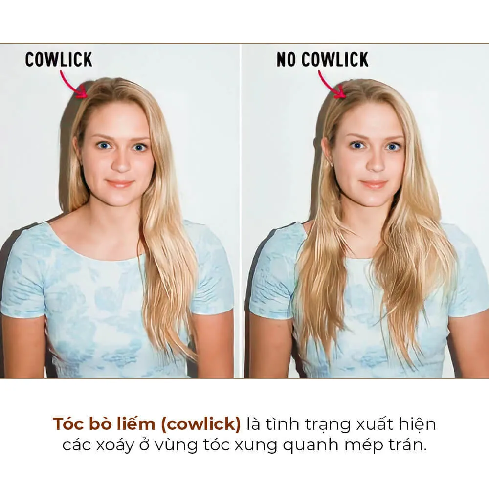Nhận biết vị trí tóc bò liếm là bước đầu tiên để xử lý hiệu quả