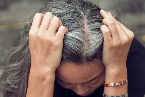 Tình trạng chân tóc bạc mọc dài khiến nhiều người mất tự tin và cần được xử lý kịp thời