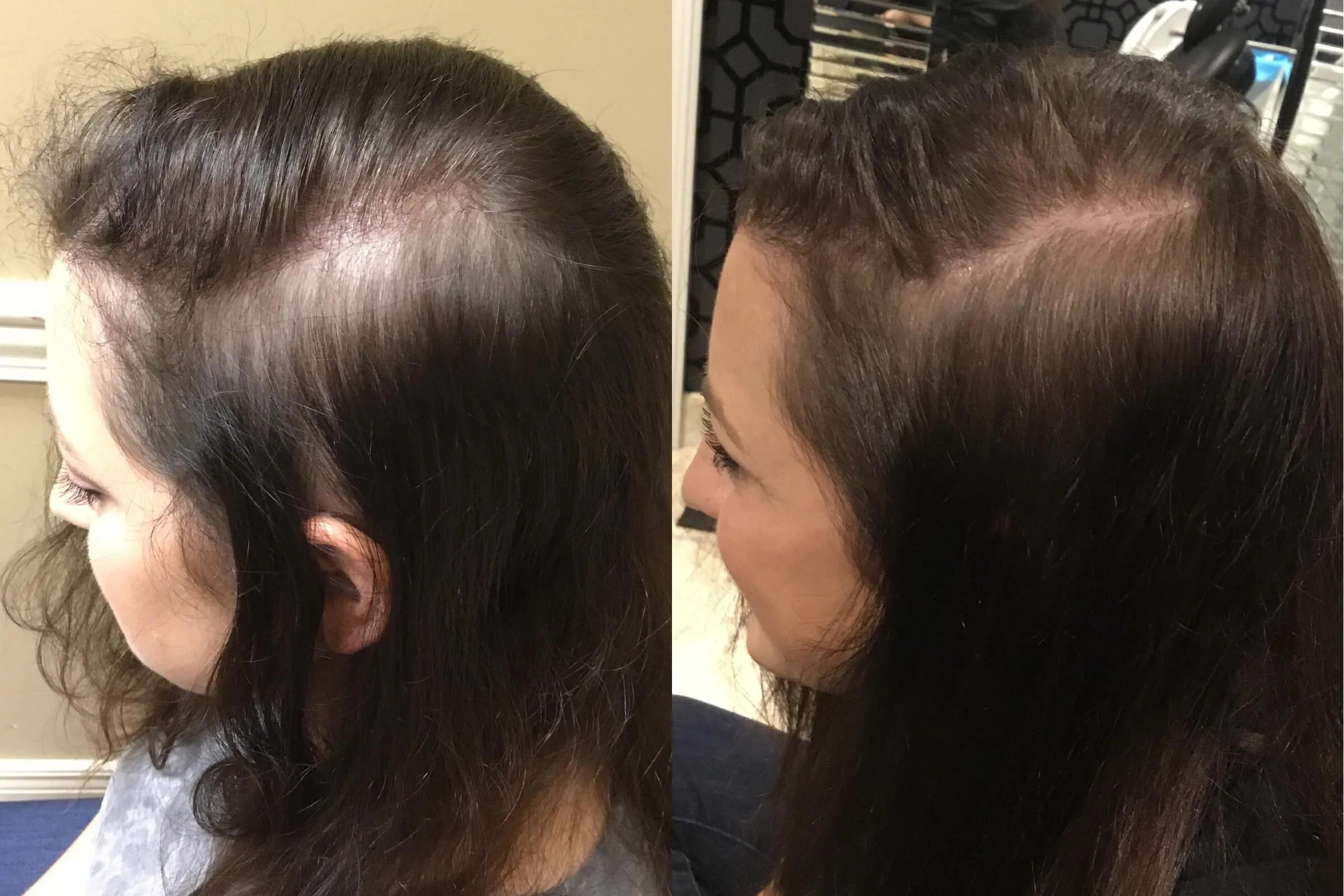 purcorganics-ginseng-hair-growth-benefits-1 Mái tóc trở nên dày và chắc khỏe hơn nhờ cơ chế kích thích tế bào mầm tóc từ nhân sâm