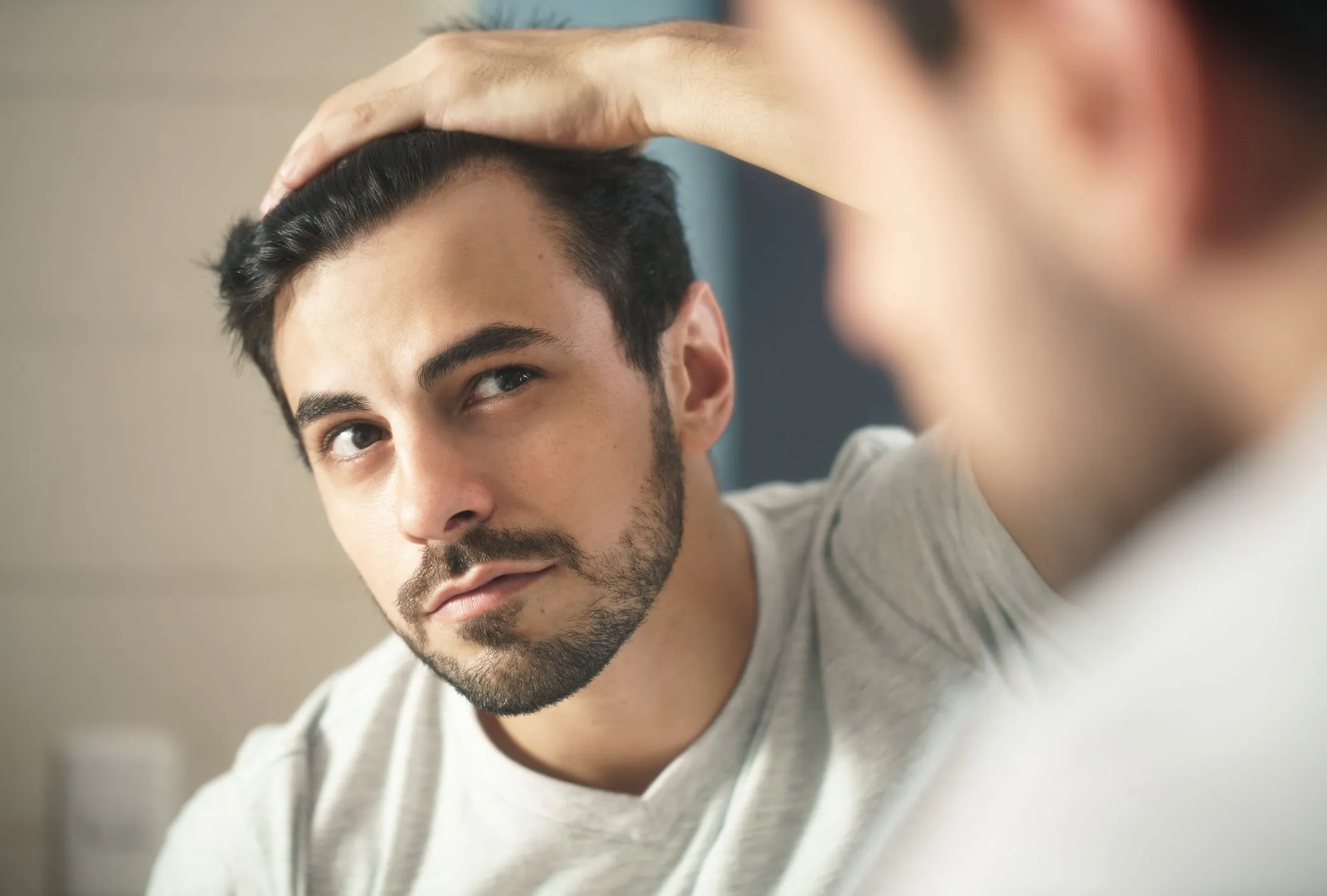Rụng tóc do DHT là nỗi lo phổ biến của nam giới hiện nay