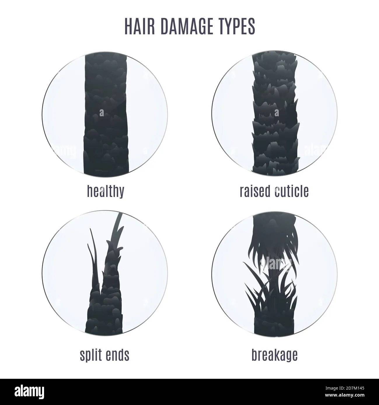 surface-of-healthy-and-damaged-hair-under-the-microscope-illustration-split-ends-breakage-and-raised-cuticle-2d7m145-3 Sự khác biệt giữa lớp biểu bì tóc khỏe mạnh và tóc bị hư tổn do oxy hóa dưới ánh nắng