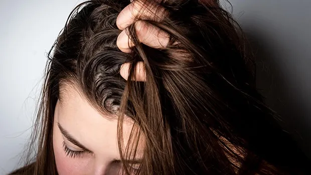 Tóc mái thưa bết dầu là nỗi ám ảnh của nhiều phái đẹp trong điều kiện khí hậu nóng ẩm