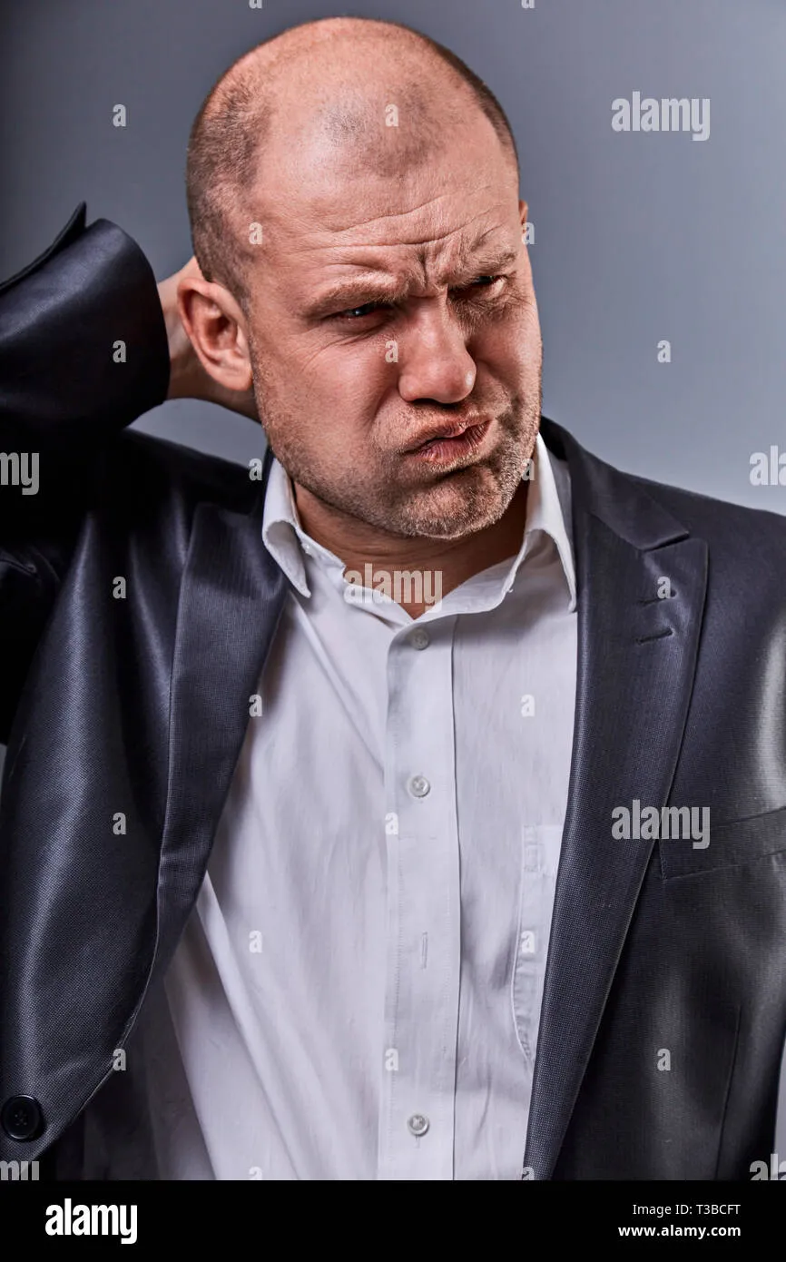 unhappy-stressed-bald-angry-business-man-holding-the-head-with-very-bad-emotions-in-office-suit-on-grey-studio-background-closeup-portrait-t3bcft Áp lực tâm lý và lối sống thiếu khoa học là những tác nhân chính thúc đẩy quá trình hói đầu sớm