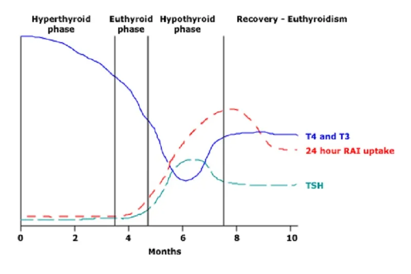 Sự mất cân bằng hormone tuyến giáp là nguyên nhân hàng đầu gây rụng lông mày và tóc