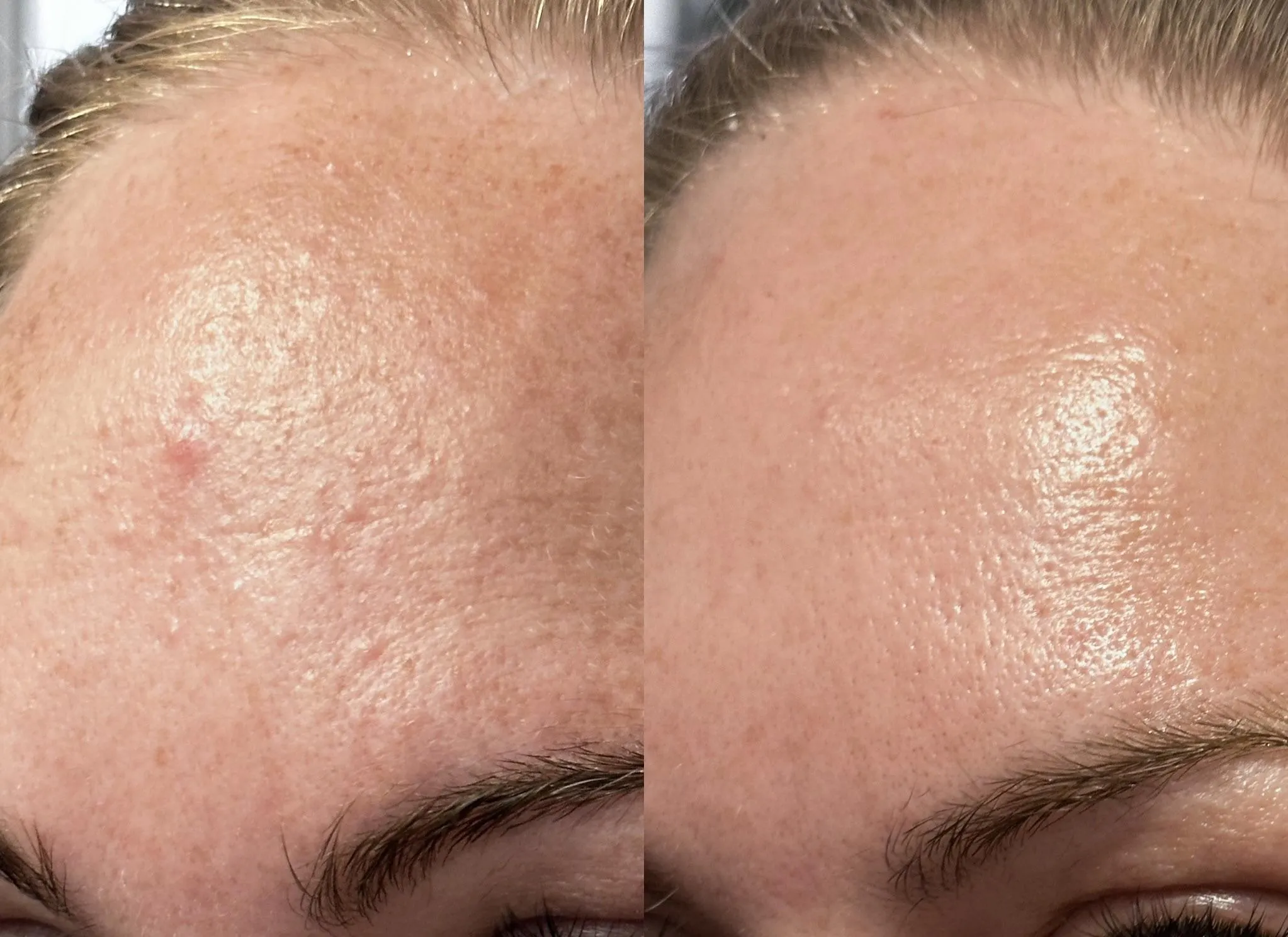 Nền da đầu sạch là điều kiện tiên quyết để serum thẩm thấu hiệu quả